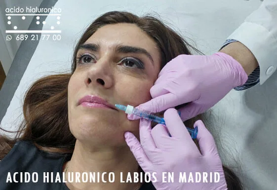 Que es el Acido Hialuronico