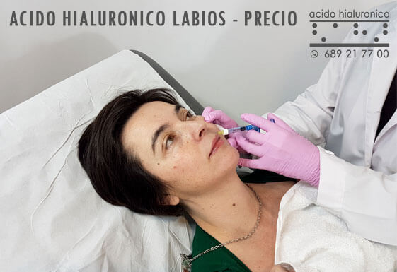 Acido Hialuronico Labios Precio Madrid