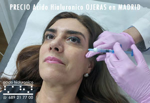Precio Acido Hialuronico Ojeras Madrid Centro Ofertas